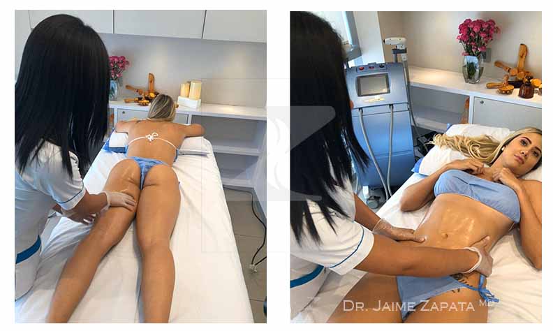 lymphatic drainage in deusas medical spa with doctor zapata plastic surgeon